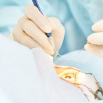 Abilitățile de microchirurgie